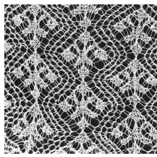 Image sur Stricken - Shetland Lace Technik